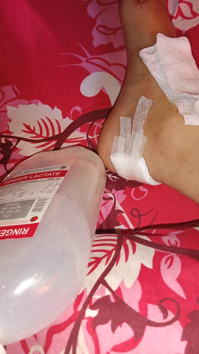 Ảnh bị ngã xe xước chân đau
