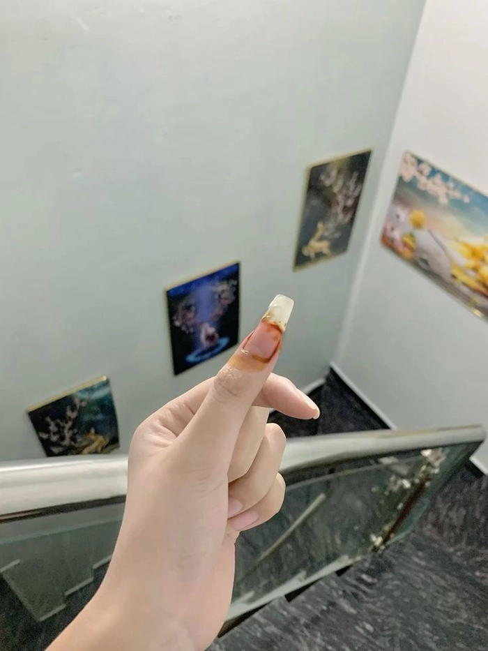 Ảnh ngã xe trầy xước nhẹ