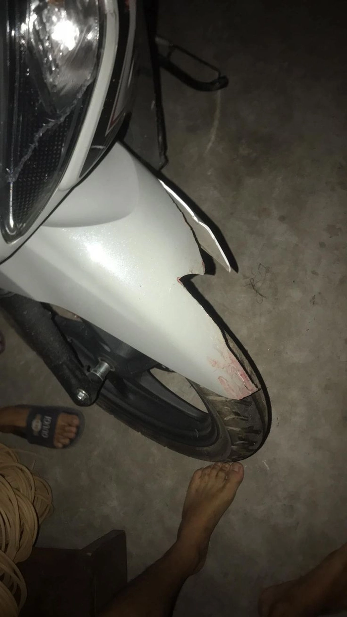 Ảnh ngã xe troll bạn bè hài bá đạo