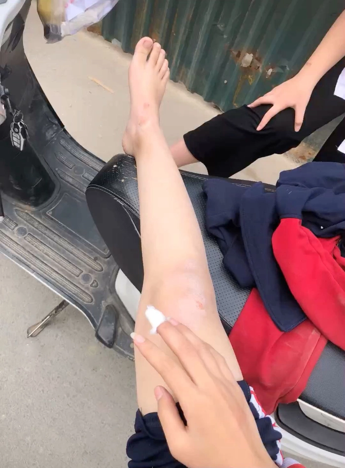 Hình ảnh ngã xe máy nhẹ hài hước